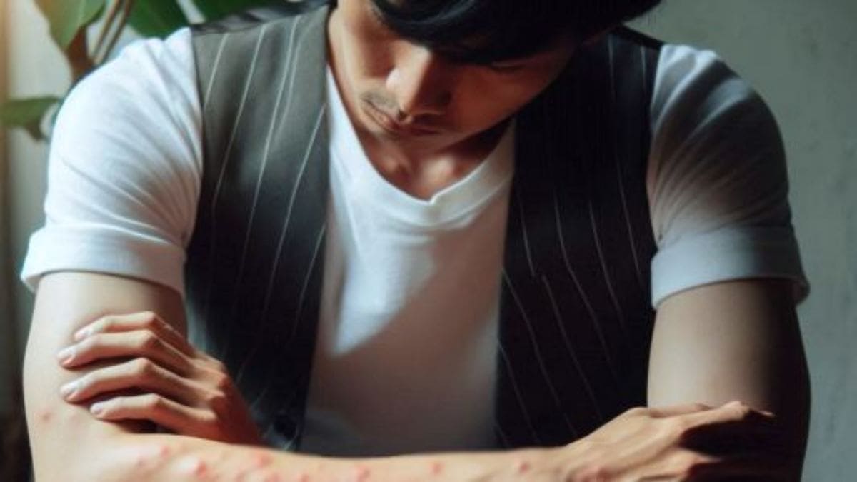 아나필락시스 쇼크 원인 및 증상과 치료 대처법