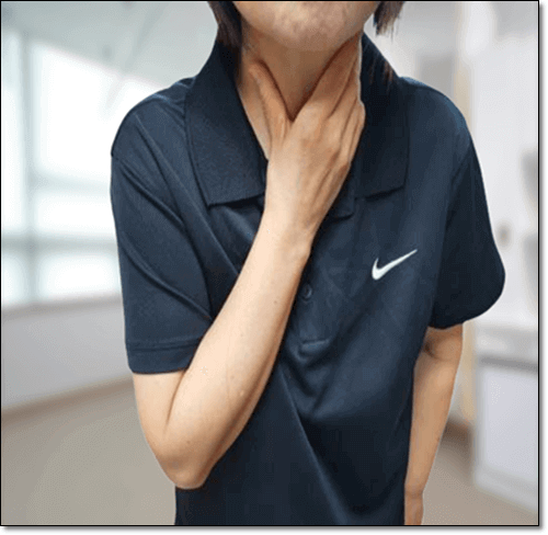 인후염 환자
