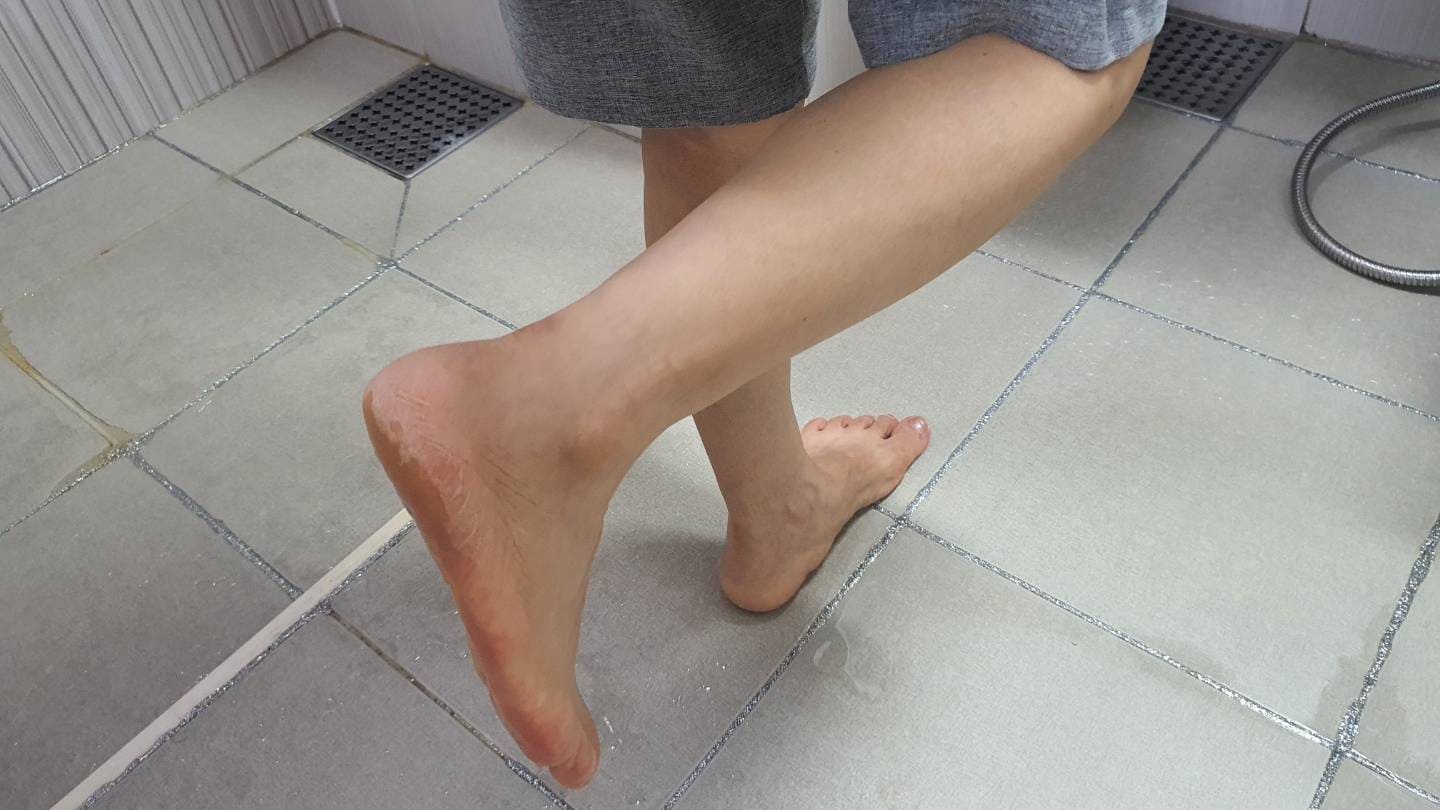 엄지발가락 통증 염증 원인 골관절염 증상일까